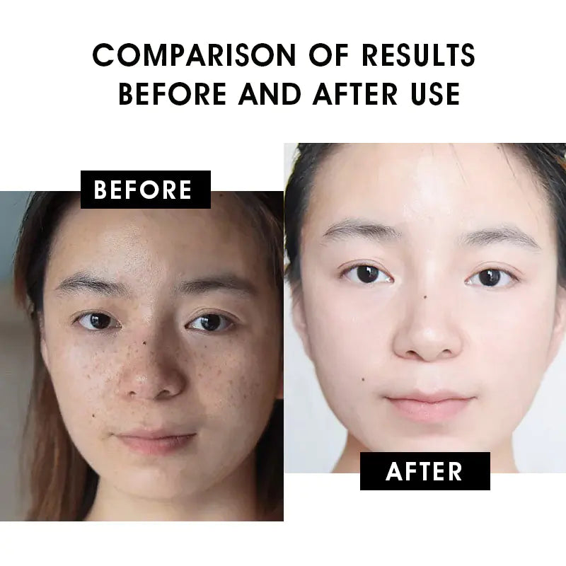 Advanced Facial Serum Collection – 30ml